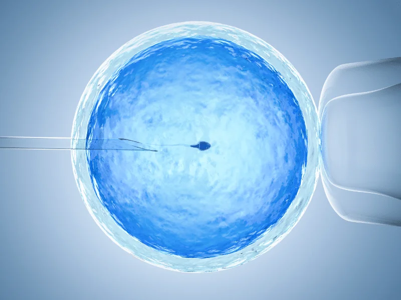 Starting IVF