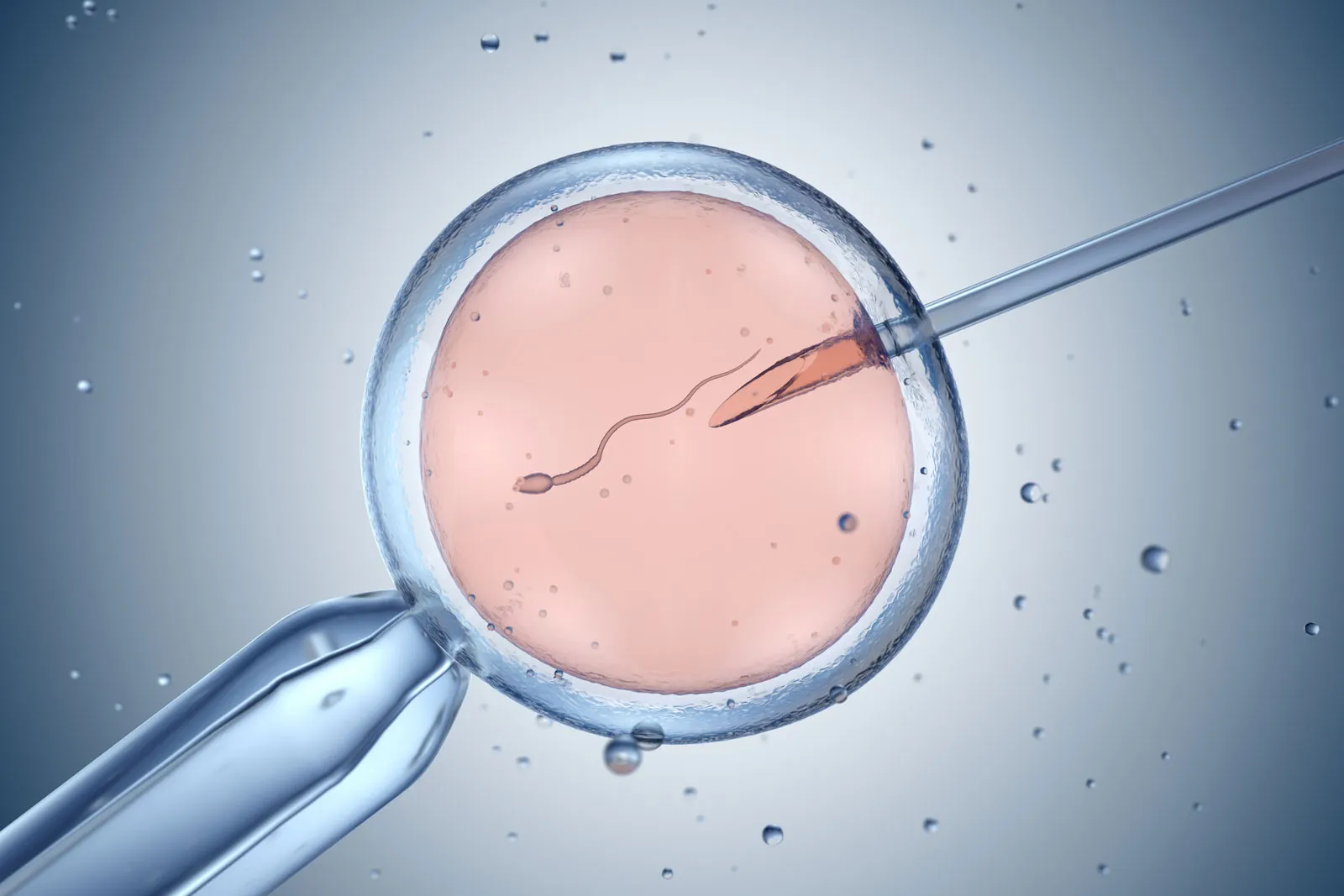 IVF + ICSI