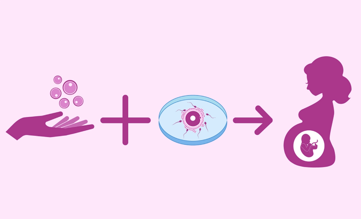 IVF with Donor Egg