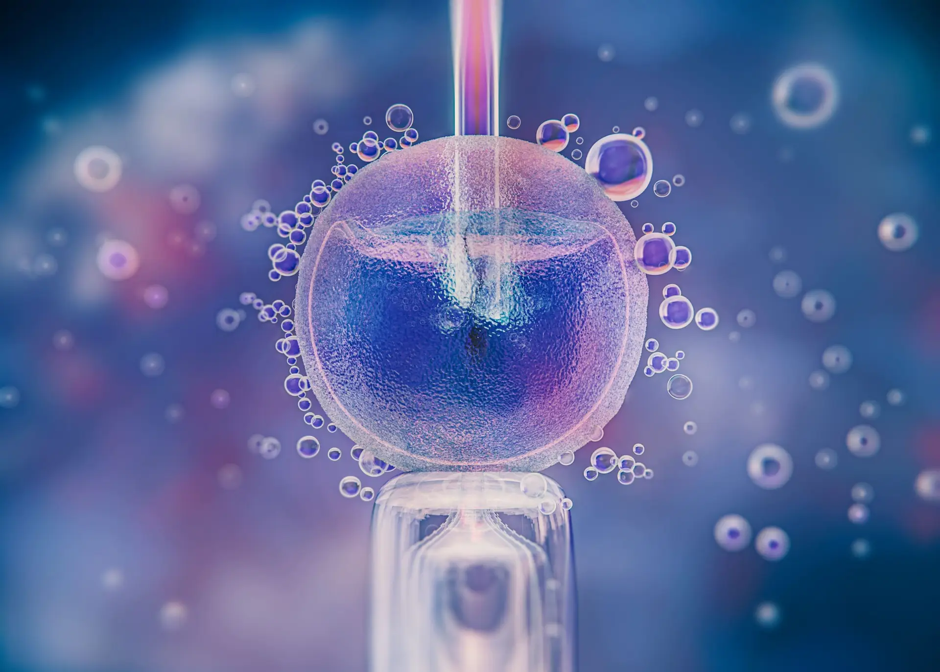 Preimplantation Genetic Screening
